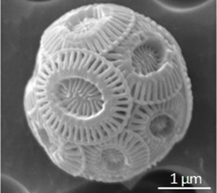 Figure 2b: Scanning electron microscope images of coccolithophore 
