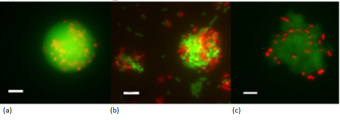 Figure 3: Nano- and micro-plastic agglomerates (green spheres) stained with the nucleic acid-specific stain acridine orange (orange dots showing bacterial cells) and observed under a fluorescence microscope. 