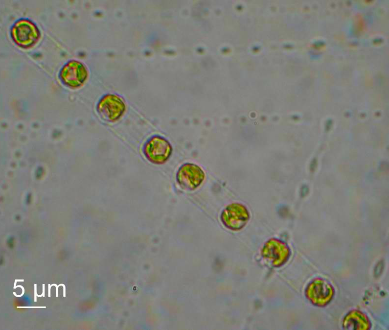 Diatom (Skeletonema spp)