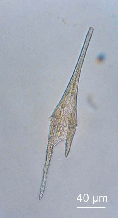 Dinoflagellate (Tripos furca)